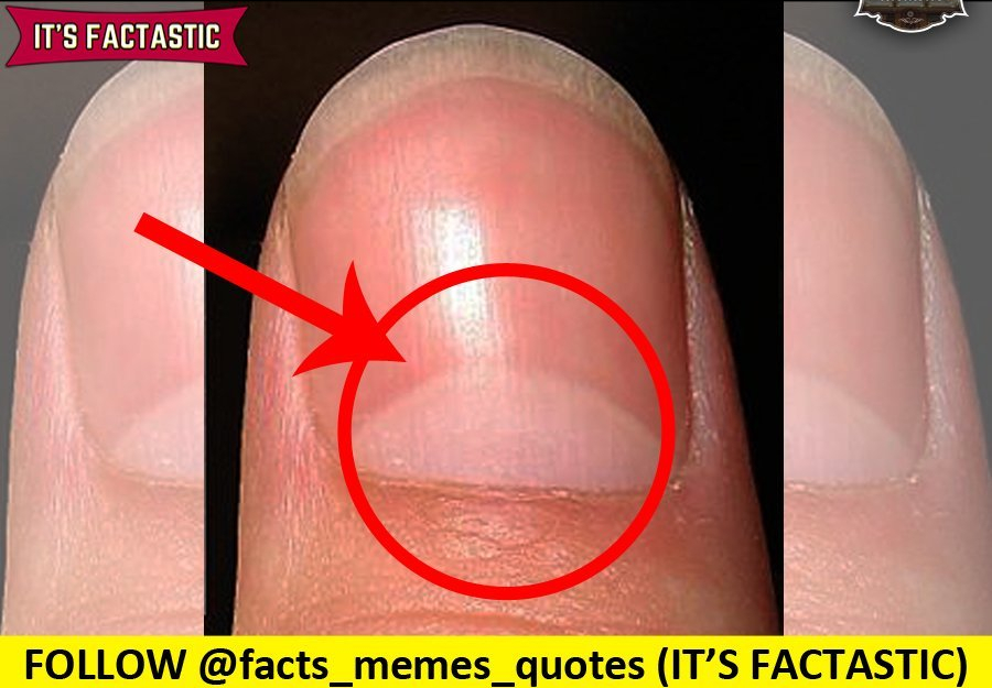 Nails,nail,fingernails,footnails,lunula